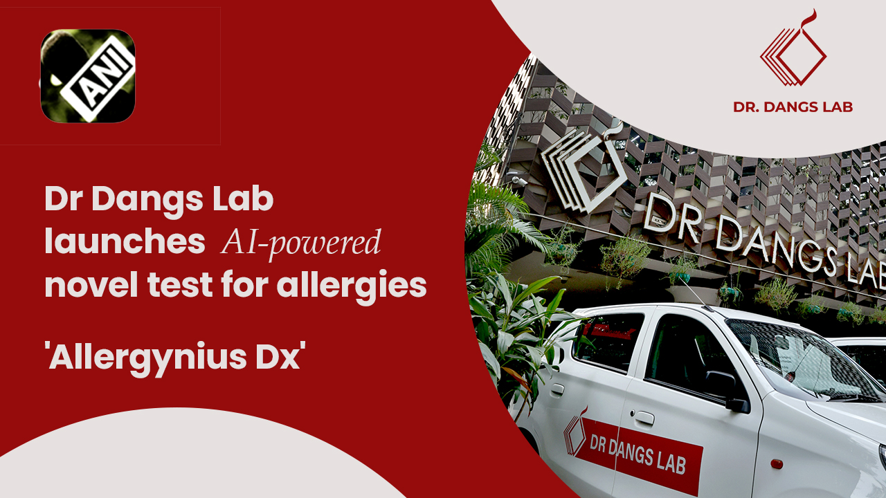 DDL Launches Allerynius Dx